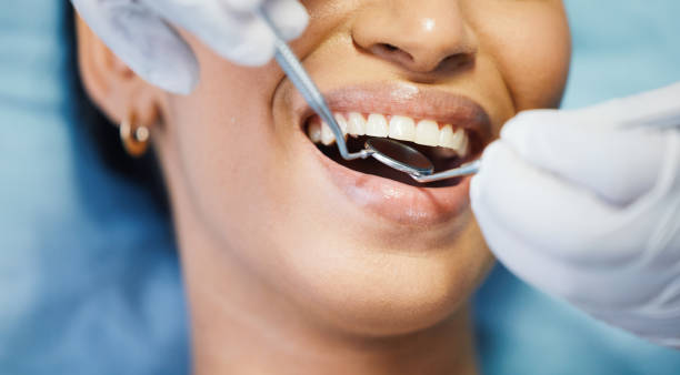 Best Emergency Gum Treatment in Madison, NC