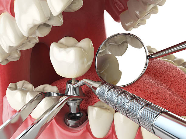 Best Cosmetic Emergency Dentistry in Madison, NC